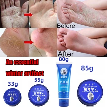 Inverno Essencial Artefato Medicina Chinesa Óleo Anti-Rachada Frostbite Reparação De Creme Para Remover A Pele Morta Da Mão E Do Pé De Cuidados Em Casa
